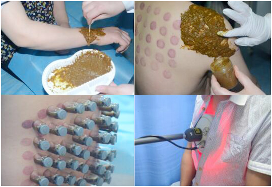 北京西京中医医院:向中医药看齐,与世界共享中医药文化(图4) 北京西京中医医院:向中医药看齐,与世界共享中医药文化(图4)